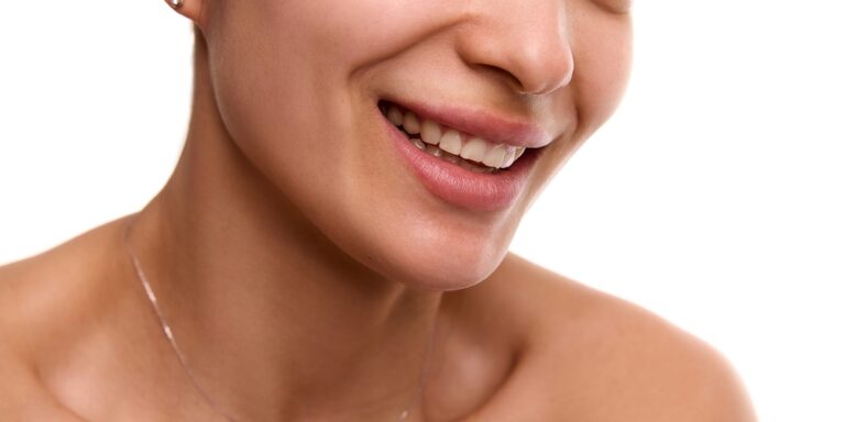 gummy smile treatment